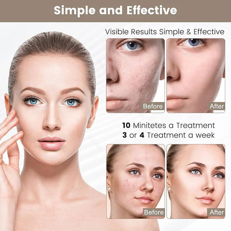 Tri Light Beauty Mask Tri Light Beauty