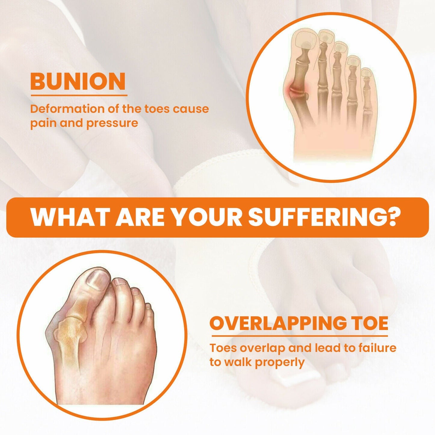 1 Pair Bunion Splint Big Toe Straightener